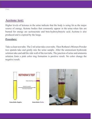 acetone paint test|acetone vs acetoacetate in urine.